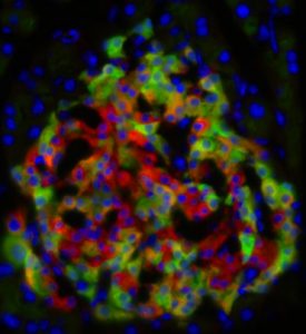 Image of a pancreatic islet. Nuclei (blue), insulin (red), and CCK (green).